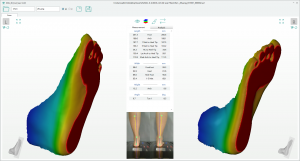 3D foot scanner