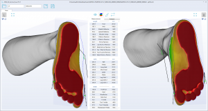 3D foot scanner
