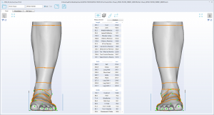 3D foot scanner